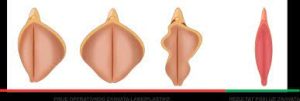 Cirurgia íntima Feminina Guia Completo, Ninfoplastia, Labioplastia e Himenoplastia.
