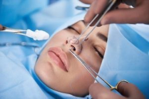 Rinoplastia em Jovens