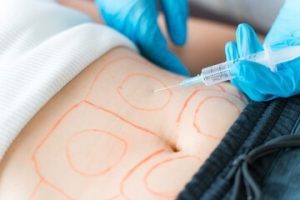 Afinal, quantos meses Pós-parto posso fazer Lipoaspiração