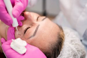 Tudo o que Você Precisa Saber Sobre Blefaroplastia
