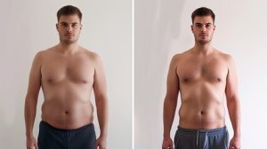 Cirurgia Plástica para Homens: Tendências e Procedimentos Mais Procurados