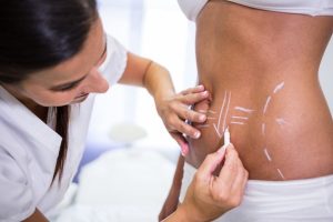 Lipo de Alta definicao 1